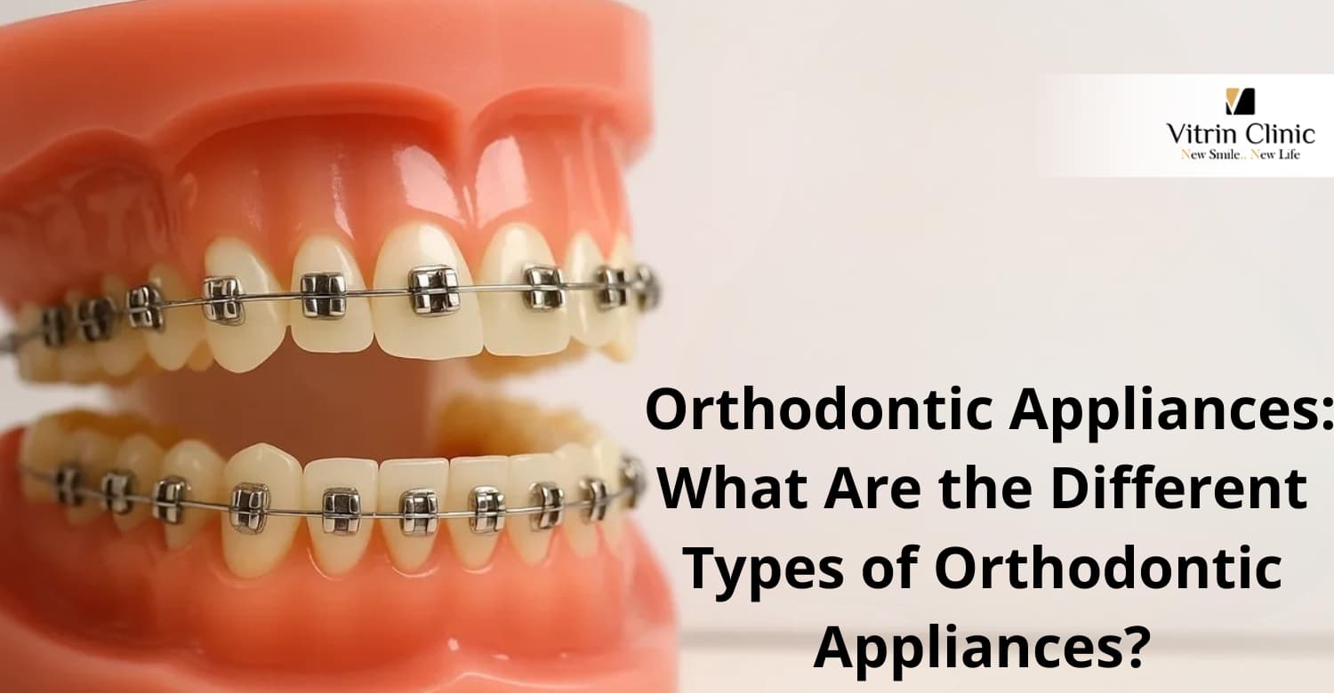 Kieferorthopädische Apparaturen: Welche verschiedenen Arten von kieferorthopädischen Apparaturen gibt es?